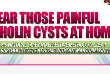 Bartholin Cysts No More Affiliates Affiliate Program